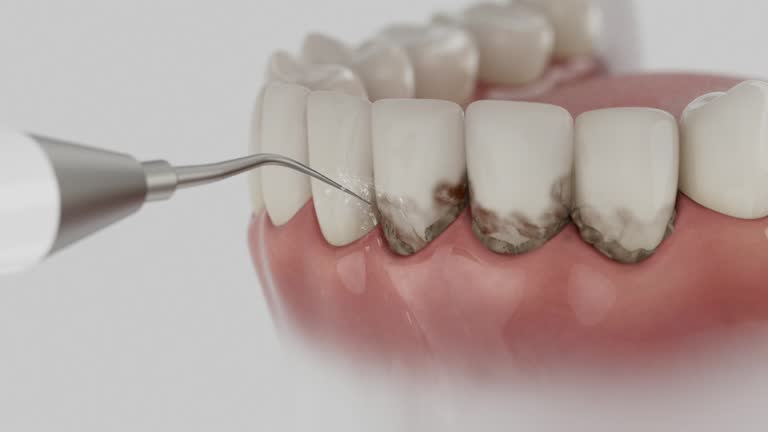 Reliable Dental Implants contractor in Grand Ledge, MI by Smile Center Dentistry